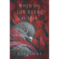 When the Sun Burns My Skin