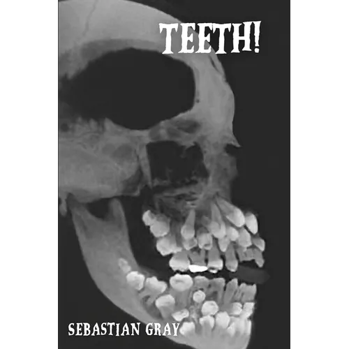 Teeth!
