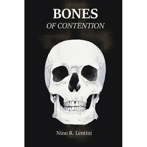 Bones of Contention